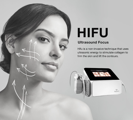 Белое HIFU наблюдает влияния обработки площади мишени